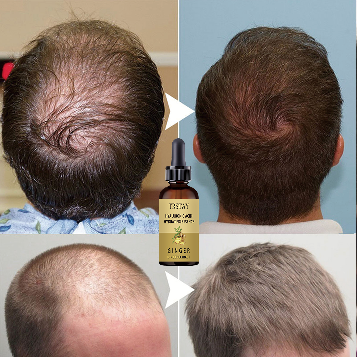 Hair Growth Serum Anti Prevent - огляд і ціна Caffeine Hair Serum