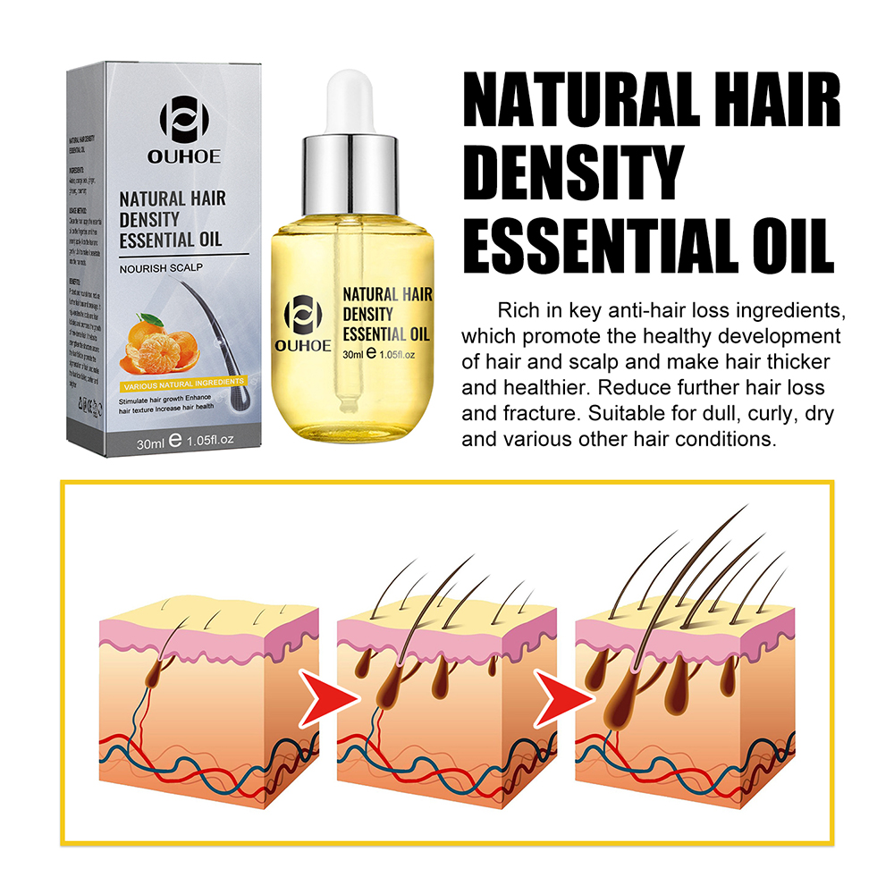 1/2PCS Ginger Hair Growth Oil  - огляд і ціна Hair Care Ginseng