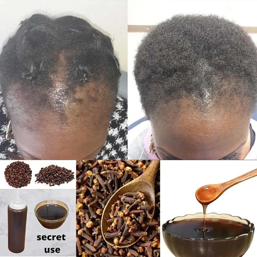 Africa Women Traction Alopecia - огляд і ціна Hair Care Ginseng
