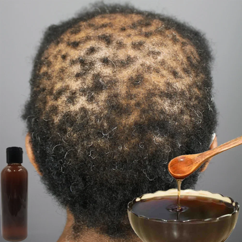 Africa Women Traction Alopecia - огляд і ціна Hair Care Ginseng