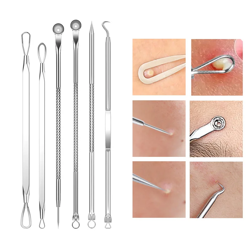 4-11Pcs Ingrown Hair Tweezers  - огляд і ціна Hair Care Clinic
