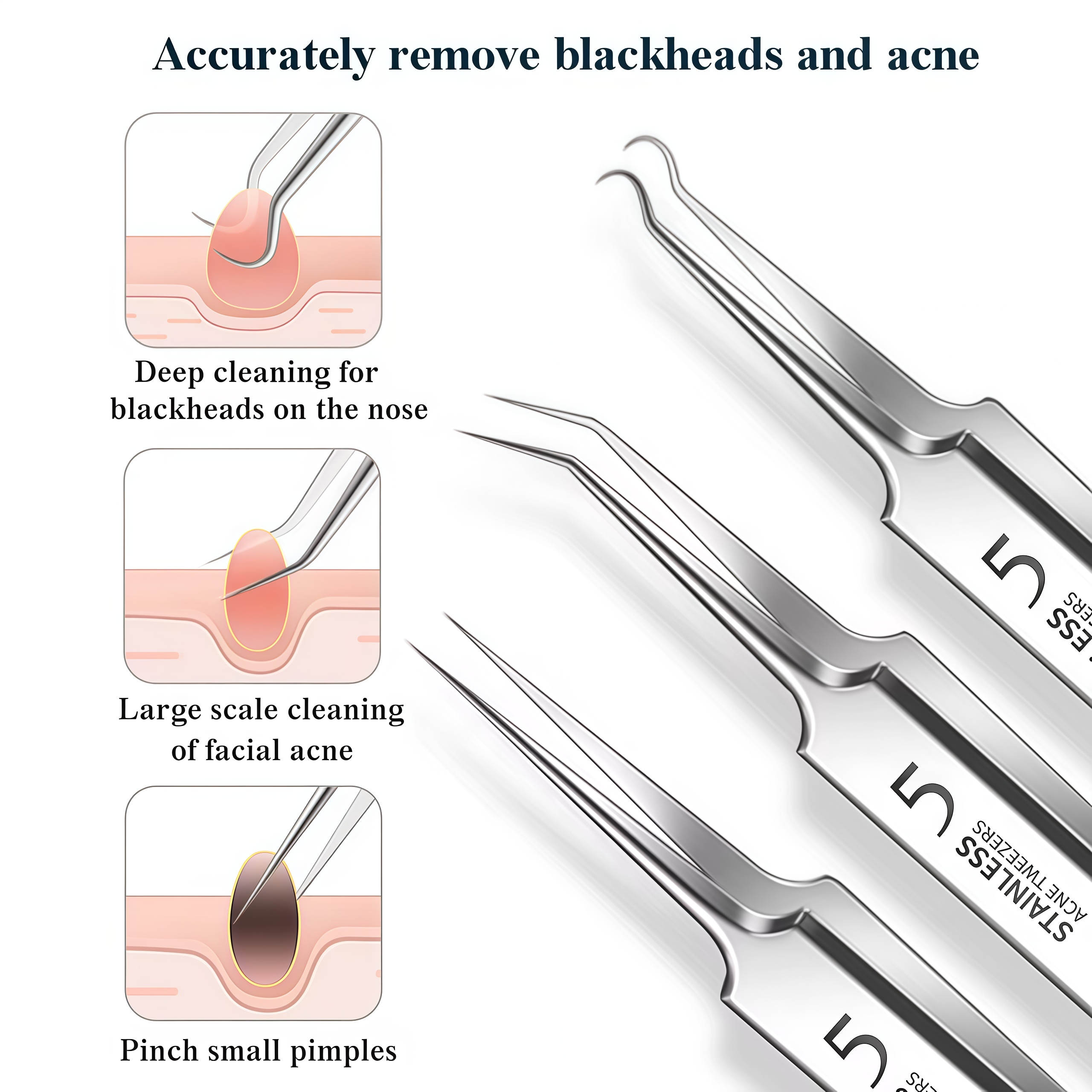 4-11Pcs Ingrown Hair Tweezers  - огляд і ціна Hair Care Clinic