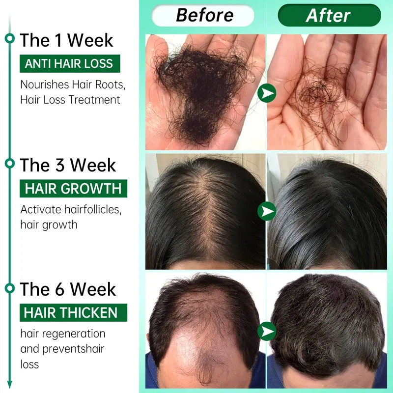 7 Days Fast Grow Hair Growth S - огляд і ціна Caffeine Hair Serum