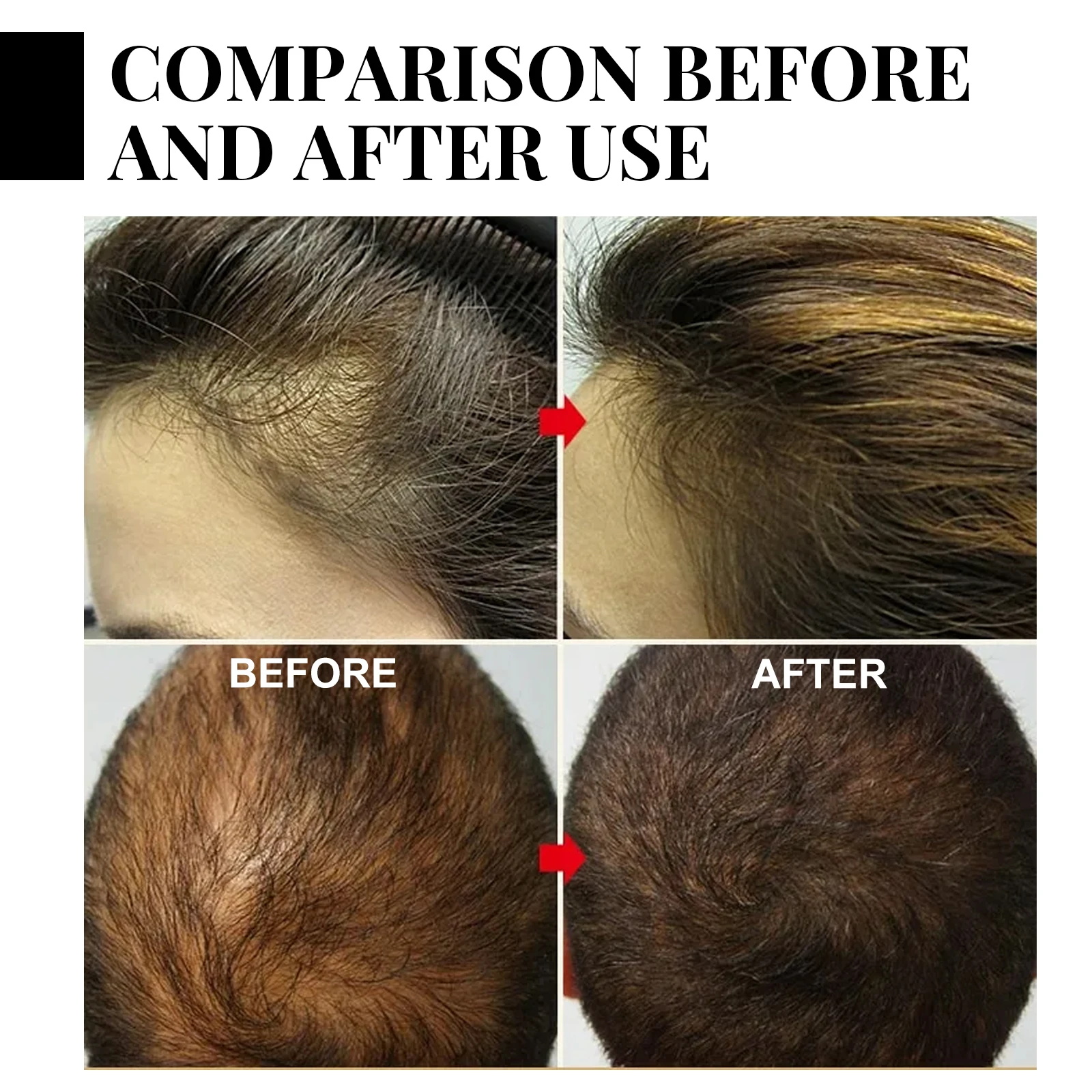 Fast Ginger Hair Growth Spray  - огляд і ціна Hair Care Nature