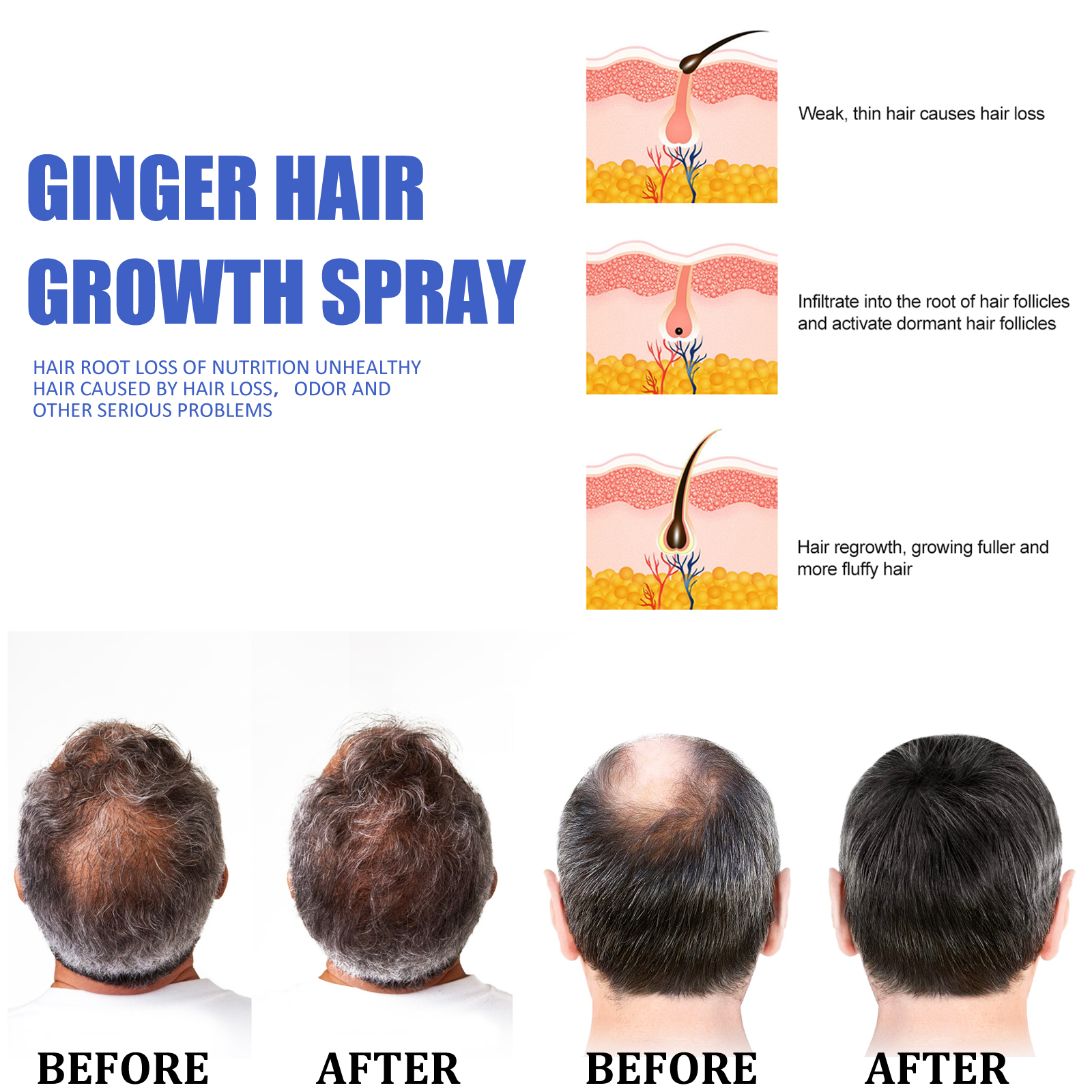 Fast Ginger Hair Growth Spray  - огляд і ціна Hair Care Nature