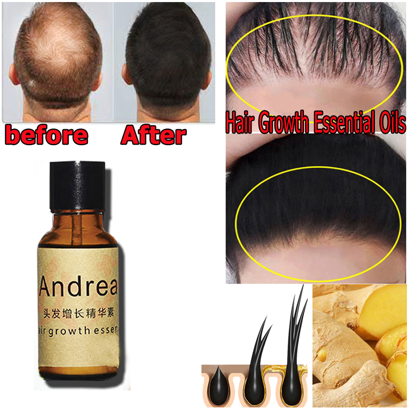 2/5/10Pcs Andrea Hair Growth S - огляд і ціна Caffeine Hair Serum